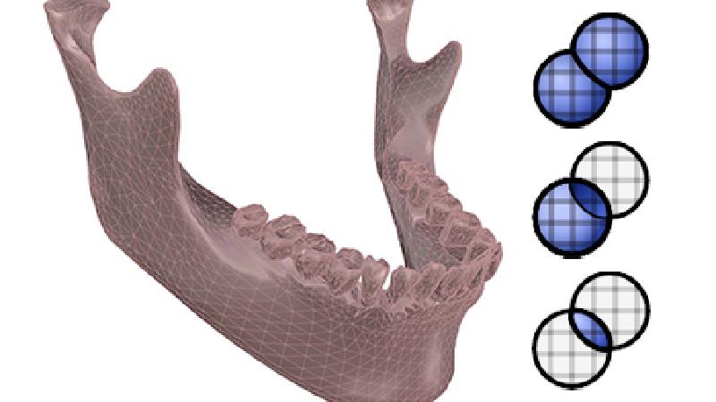 teeth-boolean.jpg